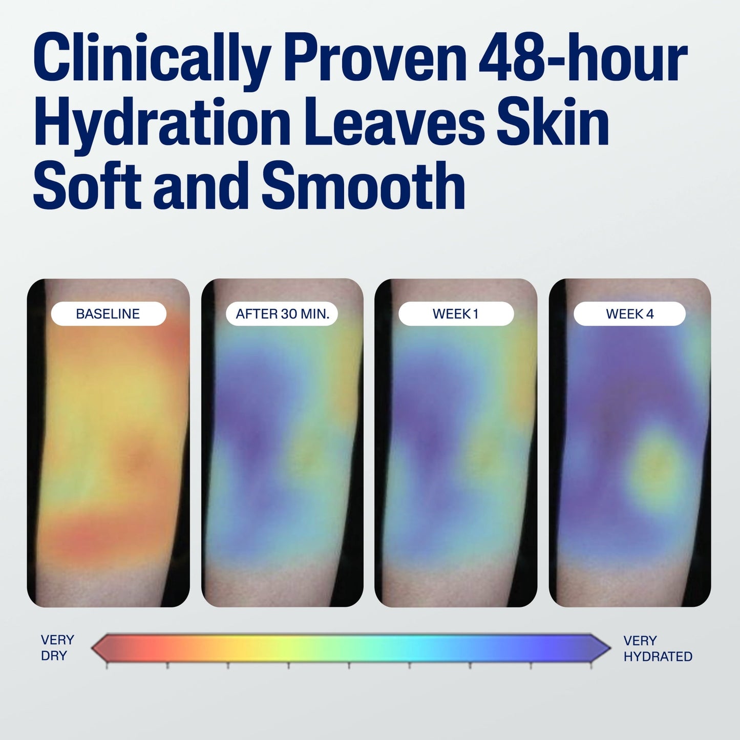 Cetaphil Moisturizing Face and Body Lotion for Normal to Dry Skin, Hydrating Fragrance Free, 16 fl oz